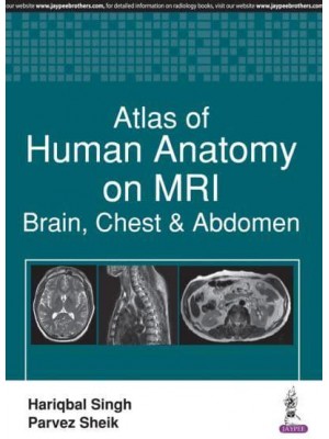 Atlas of Human Anatomy on MRI Brain, Chest & Abdomen