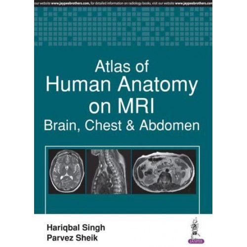 Atlas of Human Anatomy on MRI Brain, Chest & Abdomen