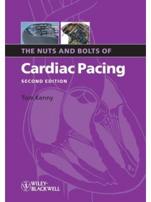 The Nuts and Bolts of Cardiac Pacing - Nuts and Bolts Series (Replaced by 5113)