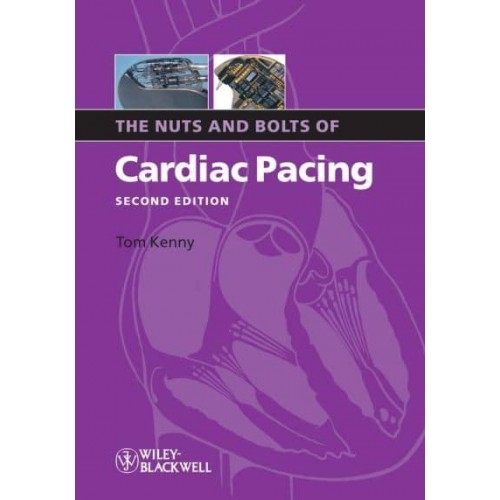 The Nuts and Bolts of Cardiac Pacing - Nuts and Bolts Series (Replaced by 5113)