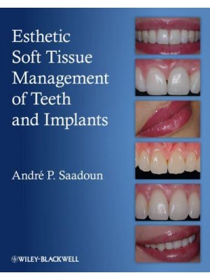 Esthetic Soft Tissue Management of Teeth and Implants