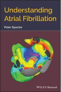 Understanding Atrial Fibrillation