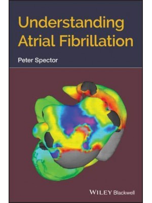 Understanding Atrial Fibrillation