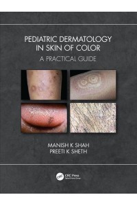 Pediatric Dermatology in Skin of Color A Practical Guide