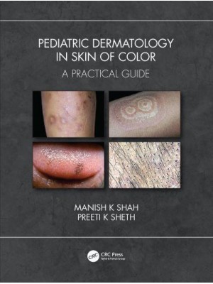 Pediatric Dermatology in Skin of Color A Practical Guide