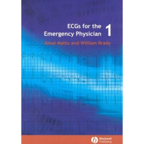 ECGs for the Emergency Physician
