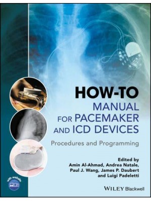 How-to Manual for Pacemaker and ICD Devices Procedures and Programming