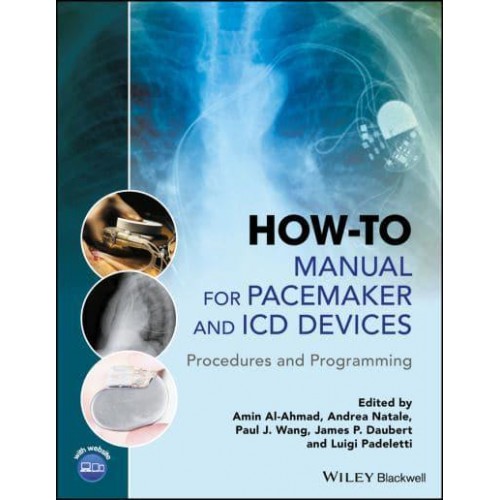 How-to Manual for Pacemaker and ICD Devices Procedures and Programming