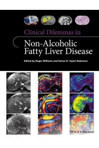 Clinical Dilemmas in Non-Alcoholic Fatty Liver Disease - Clinical Dilemmas (UK)