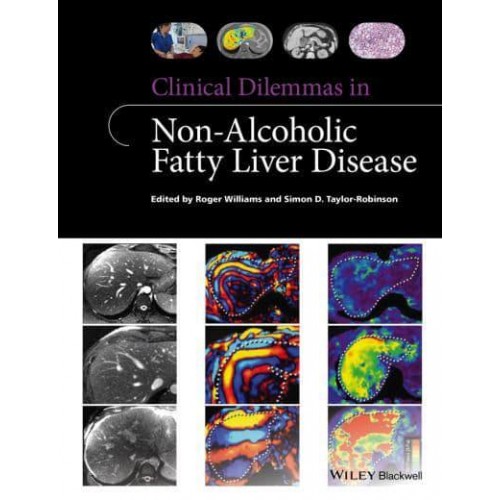 Clinical Dilemmas in Non-Alcoholic Fatty Liver Disease - Clinical Dilemmas (UK)