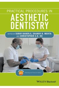 Practical Procedures in Aesthetic Dentistry