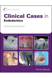 Clinical Cases in Endodontics - Clinical Cases (Dentistry)