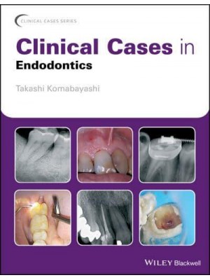 Clinical Cases in Endodontics - Clinical Cases (Dentistry)