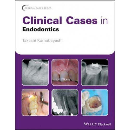Clinical Cases in Endodontics - Clinical Cases (Dentistry)
