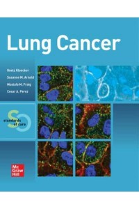 Lung Cancer Standards of Care