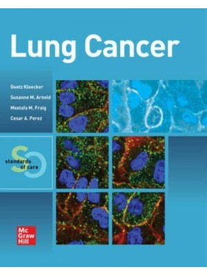 Lung Cancer Standards of Care