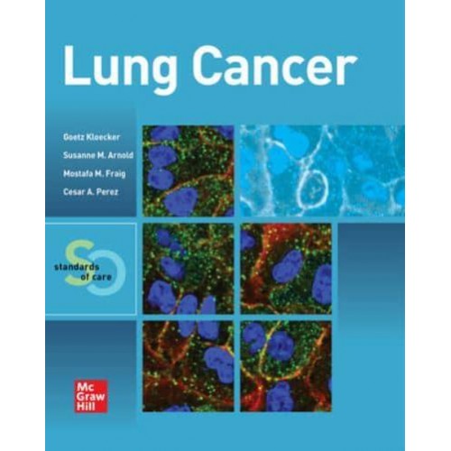 Lung Cancer Standards of Care