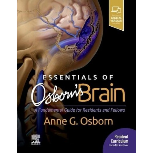 Essentials of Osborn's Brain A Fundamental Guide for Residents and Fellows