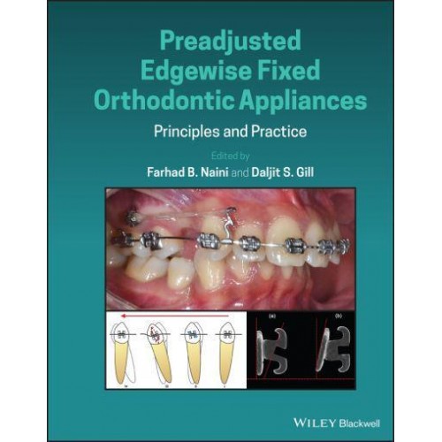 Preadjusted Edgewise Fixed Orthodontic Appliances Principles and Practice