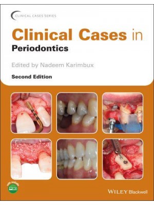 Clinical Cases in Periodontics - Clinical Cases (Dentistry)