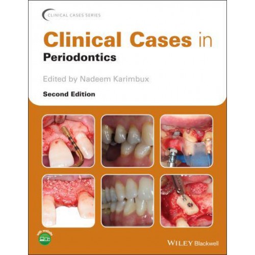 Clinical Cases in Periodontics - Clinical Cases (Dentistry)