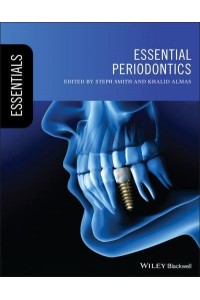Essential Periodontics - Essentials (Dentistry)