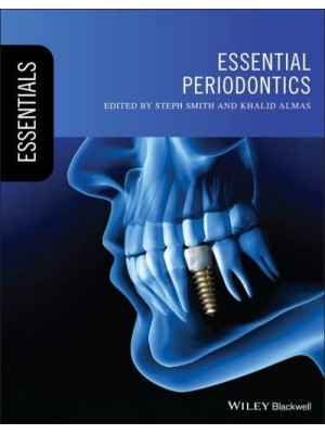 Essential Periodontics - Essentials (Dentistry)