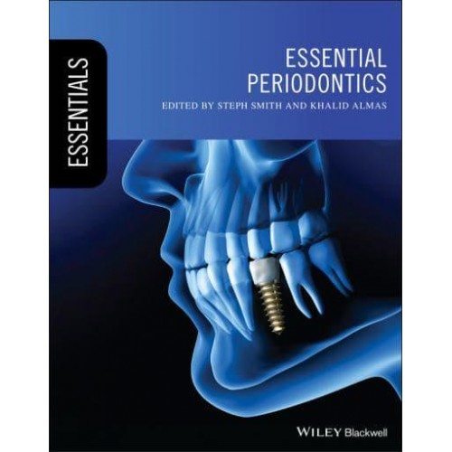Essential Periodontics - Essentials (Dentistry)