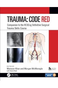 Trauma Code Red : Companion to the RCSEng Definitive Surgical Trauma Skills Course