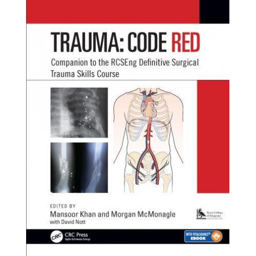 Trauma Code Red : Companion to the RCSEng Definitive Surgical Trauma Skills Course