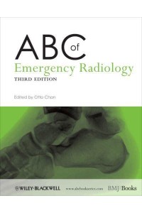 ABC of Emergency Radiology - ABC Series