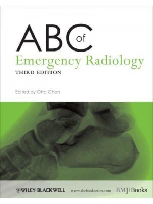 ABC of Emergency Radiology - ABC Series