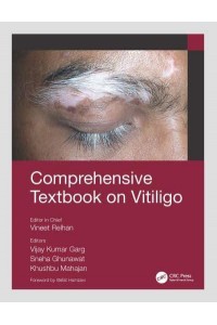 Comprehensive Textbook on Vitiligo