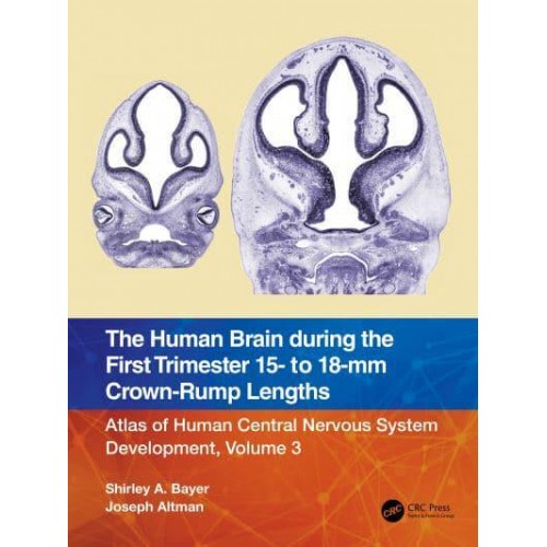 The Human Brain During the First Trimester 15- To 18-Mm Crown-Rump Lengths - Atlas of Human Central Nervous System Development
