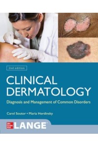 Clinical Dermatology Diagnosis and Management of Common Disorders - A Lange Medical Book