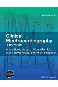 Clinical Electrocardiography A Textbook