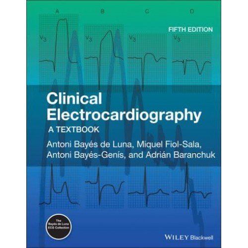 Clinical Electrocardiography A Textbook