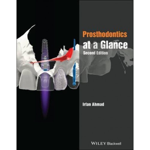 Prosthodontics at a Glance - At a Glance (Dentistry)