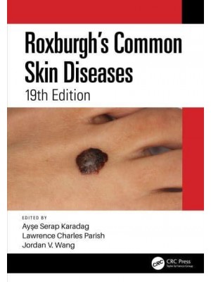 Roxburgh's Common Skin Diseases