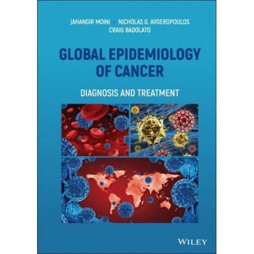 Global Epidemiology of Cancer Diagnosis and Treatment