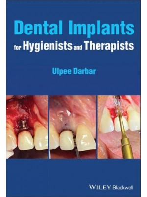 Dental Implants for Hygienists and Therapists