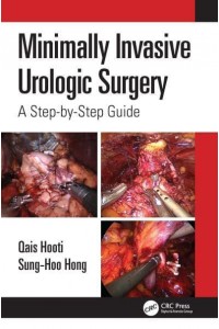 Minimally Invasive Urologic Surgery A Step-by-Step Guide