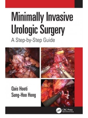 Minimally Invasive Urologic Surgery A Step-by-Step Guide