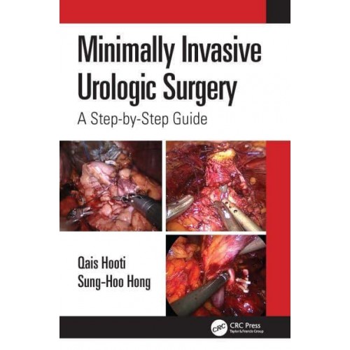 Minimally Invasive Urologic Surgery A Step-by-Step Guide