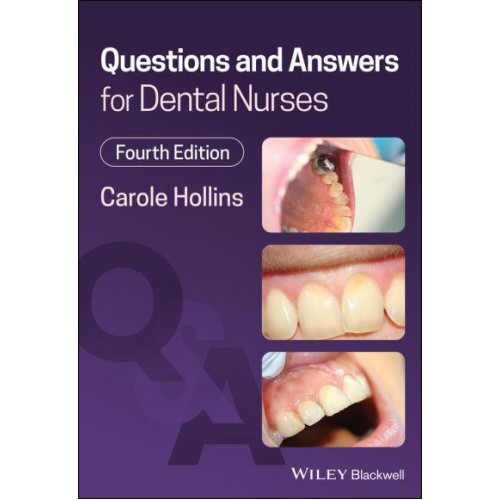 Questions and Answers for Dental Nurses