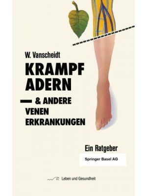 Krampfadern Und Andere Venenerkrankungen: Ein Ratgeber - Leben Und Gesundheit