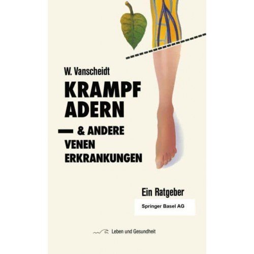 Krampfadern Und Andere Venenerkrankungen: Ein Ratgeber - Leben Und Gesundheit