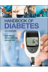 Handbook of Diabetes
