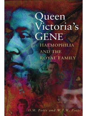 Queen Victoria's Gene Haemophilia and the Royal Family